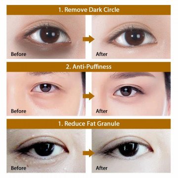 Augenklappen entfernen dunkle Ringe, feuchtigkeitsspendende Augenmaske